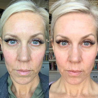 michelle schaffer collagen